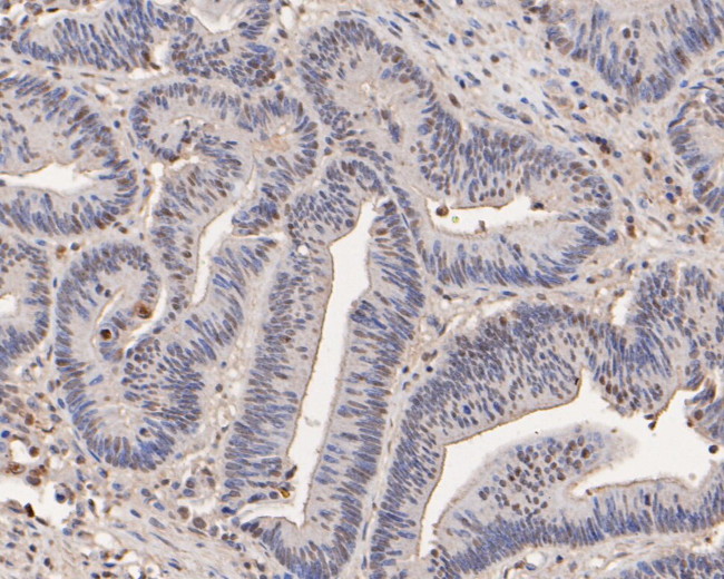 RBBP7 Antibody in Immunohistochemistry (Paraffin) (IHC (P))