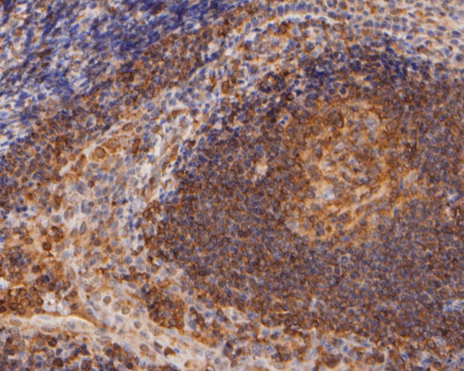 Flightless 1 Antibody in Immunohistochemistry (Paraffin) (IHC (P))