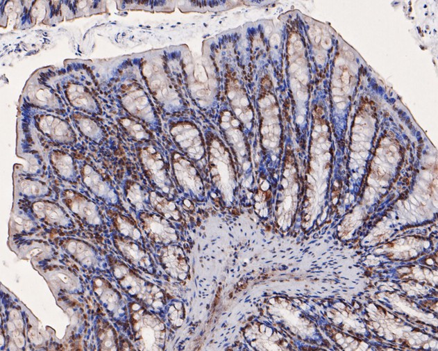 ATR Antibody in Immunohistochemistry (Paraffin) (IHC (P))