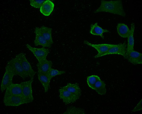 LIM Kinase 1 Antibody in Immunocytochemistry (ICC/IF)