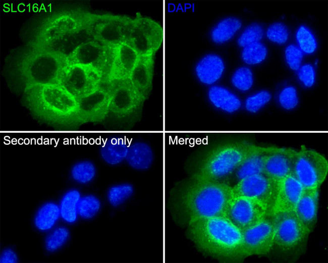 Monocarboxylic acid transporter 1 Antibody in Immunocytochemistry (ICC/IF)