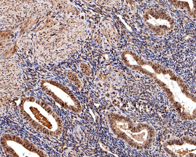 CREBBP Antibody in Immunohistochemistry (Paraffin) (IHC (P))