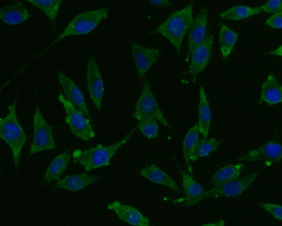 GLP-1R Antibody in Immunocytochemistry (ICC/IF)