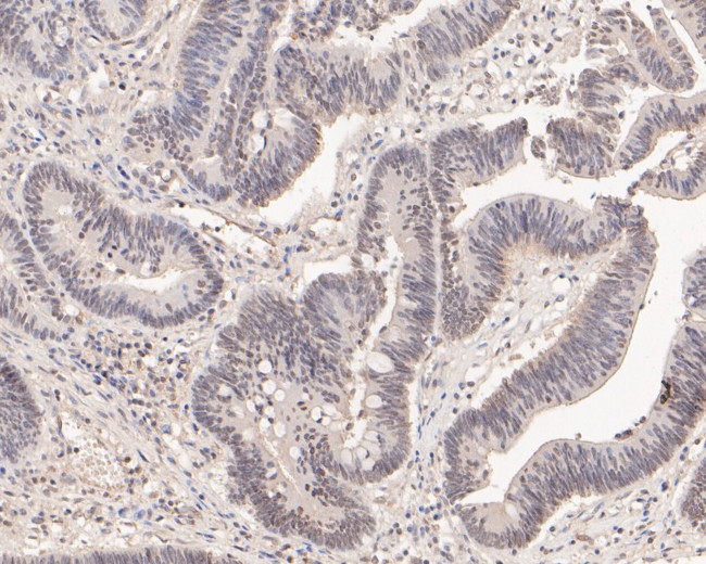 DP2 Antibody in Immunohistochemistry (Paraffin) (IHC (P))
