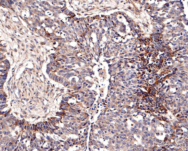 ChT1 Antibody in Immunohistochemistry (Paraffin) (IHC (P))