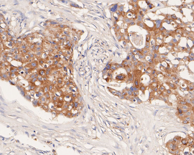 CX3CL1 Antibody in Immunohistochemistry (Paraffin) (IHC (P))