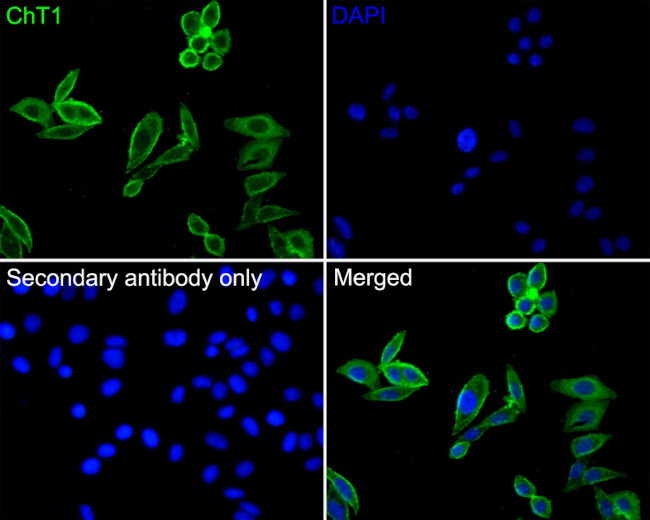 ChT1 Antibody in Immunocytochemistry (ICC/IF)