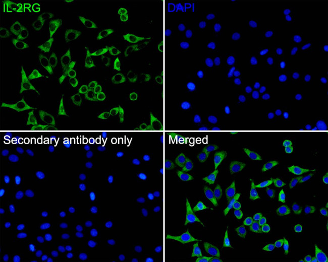 IL-2RG Antibody in Immunocytochemistry (ICC/IF)
