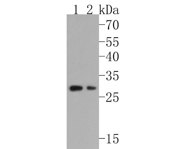 Cyclin D2 Antibody in Western Blot (WB)