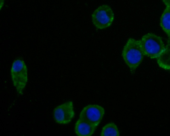 CPN1 Antibody in Immunocytochemistry (ICC/IF)