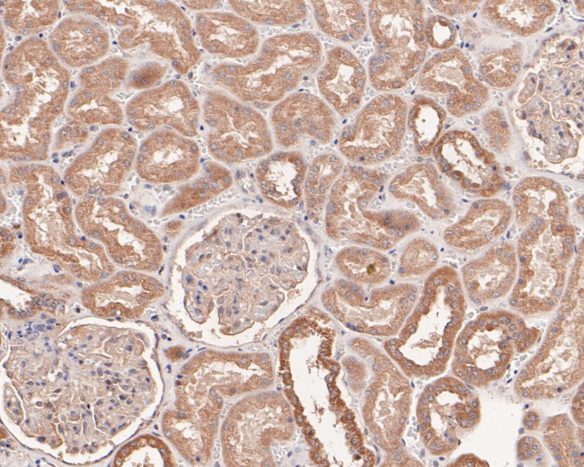 LAMB3 Antibody in Immunohistochemistry (Paraffin) (IHC (P))