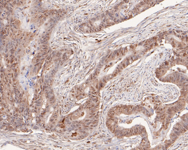 p107 Antibody in Immunohistochemistry (Paraffin) (IHC (P))
