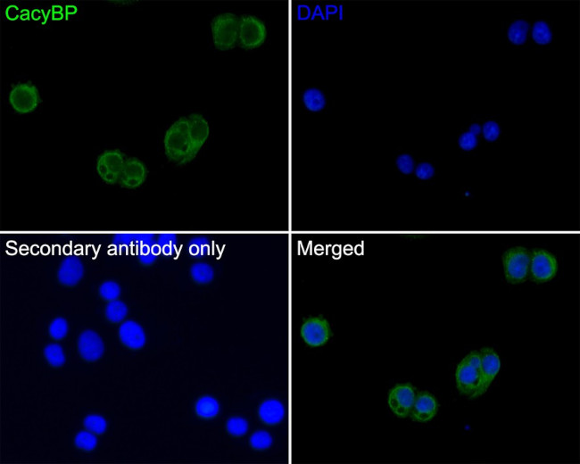 CacyBP Antibody in Immunocytochemistry (ICC/IF)