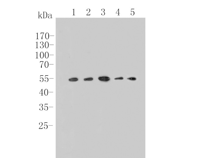 TGF beta 1 Antibody in Western Blot (WB)