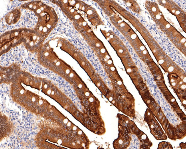 Villin1 Antibody in Immunohistochemistry (Paraffin) (IHC (P))