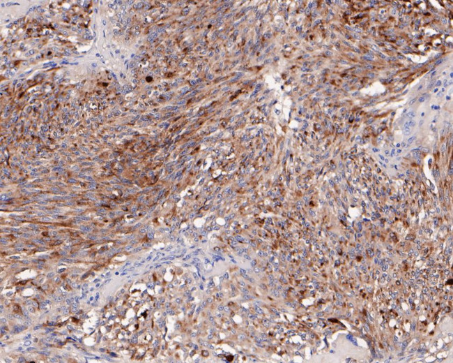 Chromogranin A Antibody in Immunohistochemistry (Paraffin) (IHC (P))
