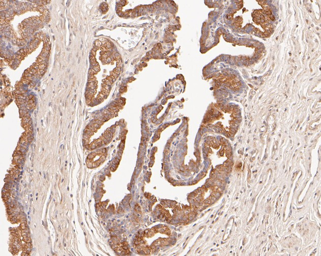 Cytokeratin 18 Antibody in Immunohistochemistry (Paraffin) (IHC (P))