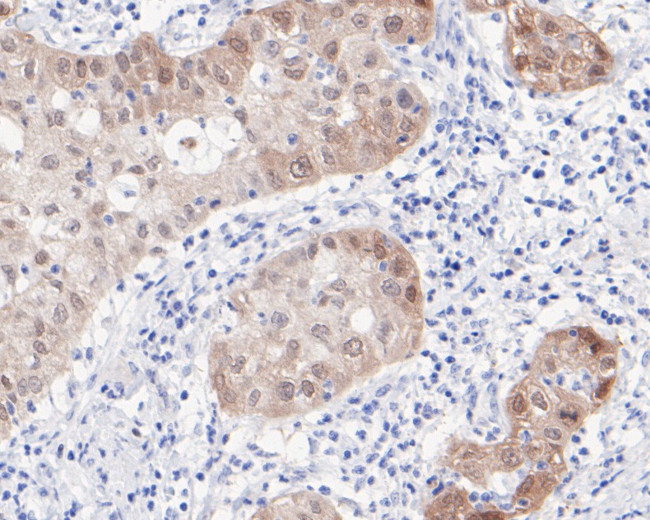 p16INK4a Antibody in Immunohistochemistry (Paraffin) (IHC (P))