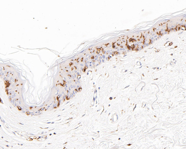 CD1A Antibody in Immunohistochemistry (Paraffin) (IHC (P))