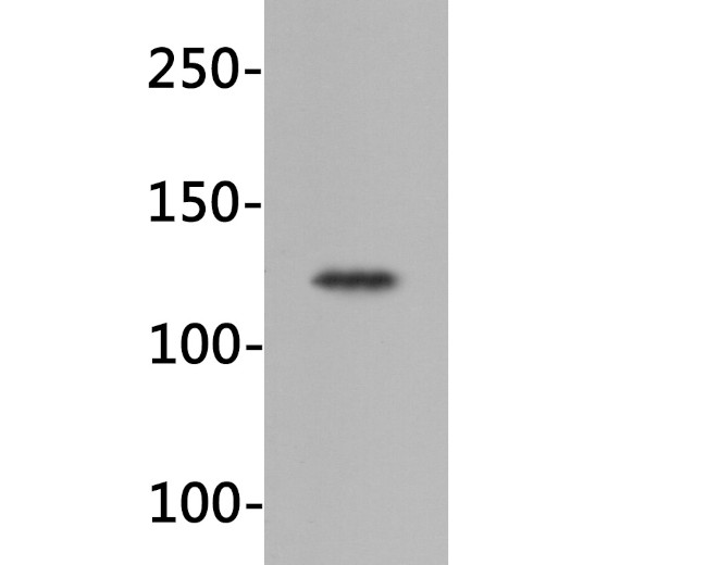 IGF1R Antibody in Western Blot (WB)