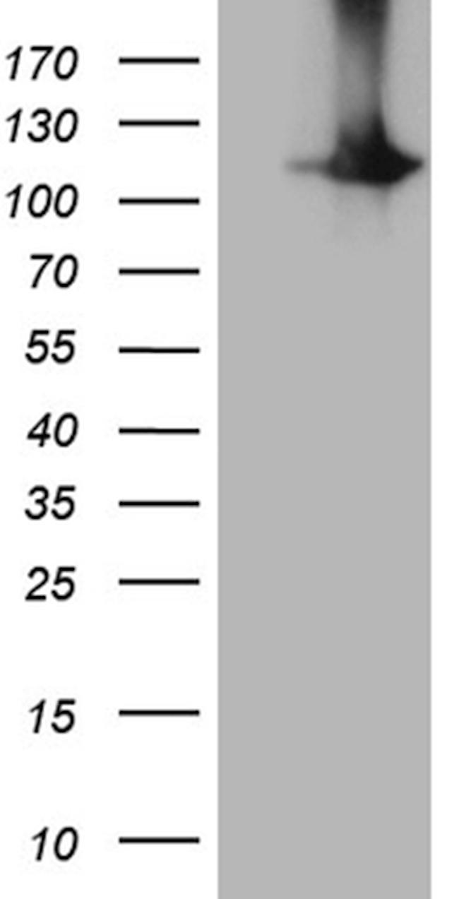 HACE1 Antibody in Western Blot (WB)