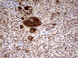 HADH Antibody in Immunohistochemistry (Paraffin) (IHC (P))