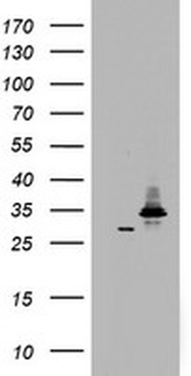 HADH Antibody in Western Blot (WB)