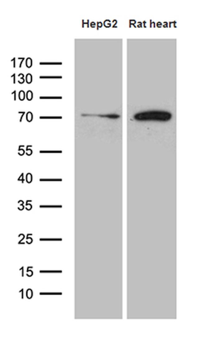 HADHA Antibody in Western Blot (WB)