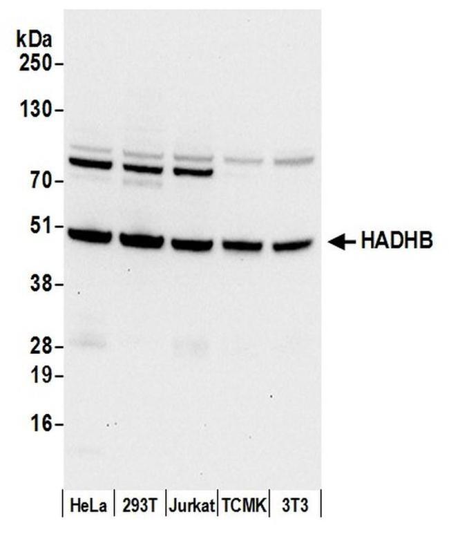 HADHB Antibody in Western Blot (WB)