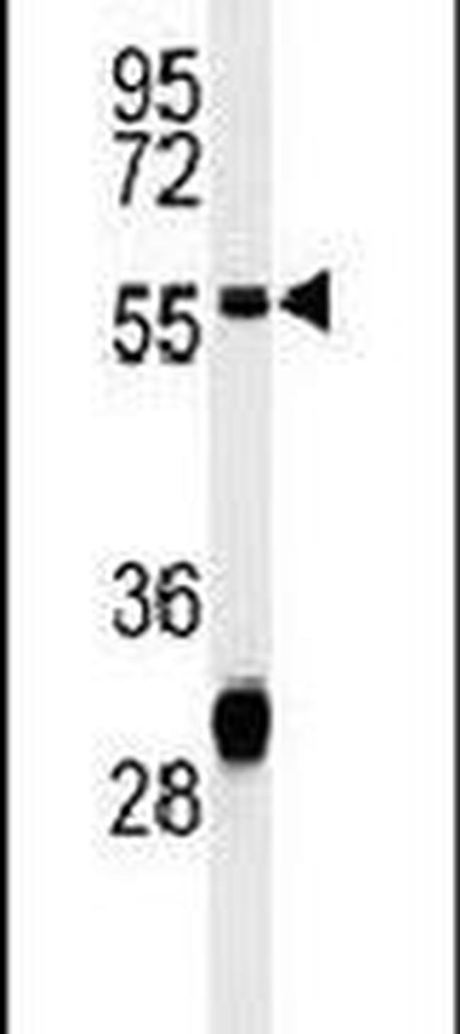 HADHB Antibody in Western Blot (WB)