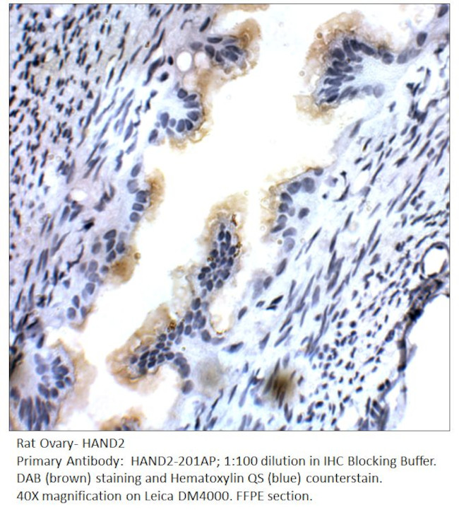 HAND2 Antibody in Immunohistochemistry (IHC)