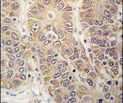 HARS Antibody in Immunohistochemistry (IHC)