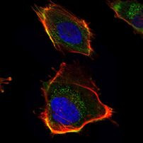 HAS1 Antibody in Immunocytochemistry (ICC/IF)