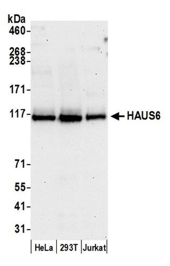 HAUS6 Antibody in Western Blot (WB)