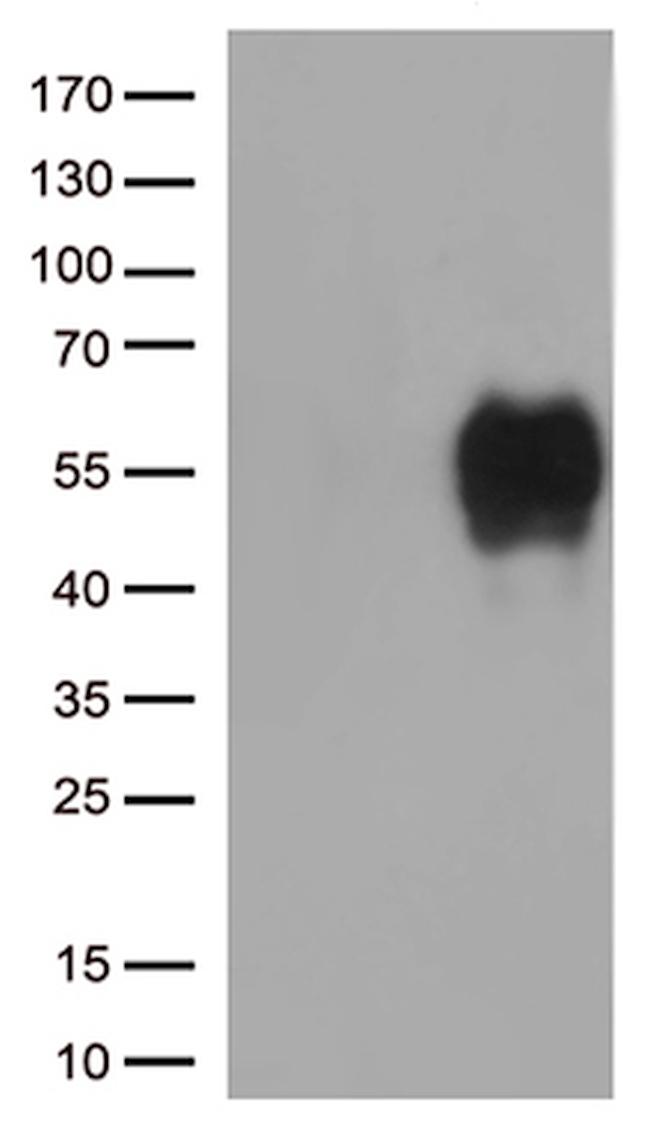 HAVCR2 Antibody in Western Blot (WB)