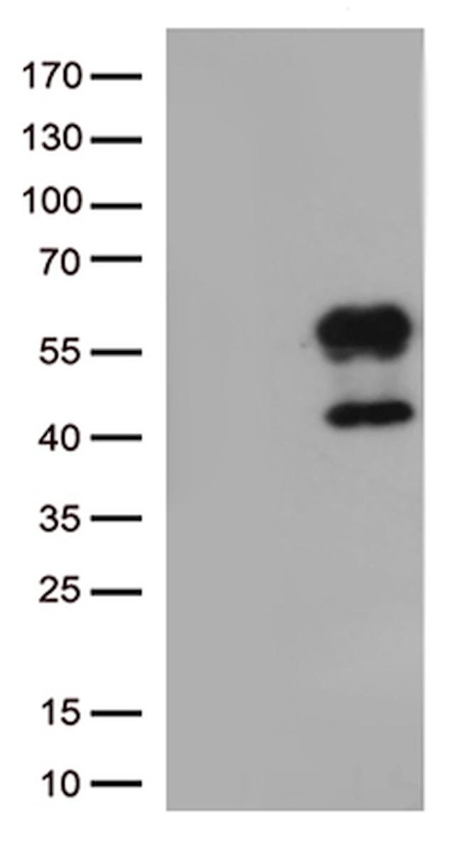 HAVCR2 Antibody in Western Blot (WB)