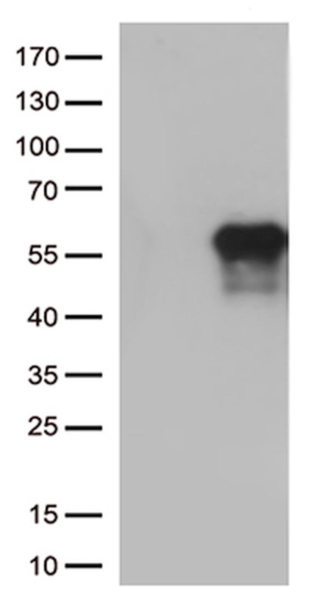 HAVCR2 Antibody in Western Blot (WB)
