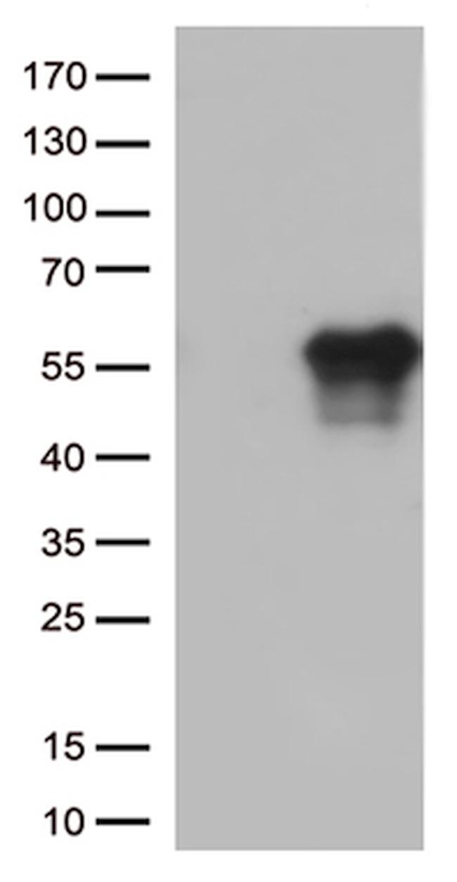HAVCR2 Antibody in Western Blot (WB)