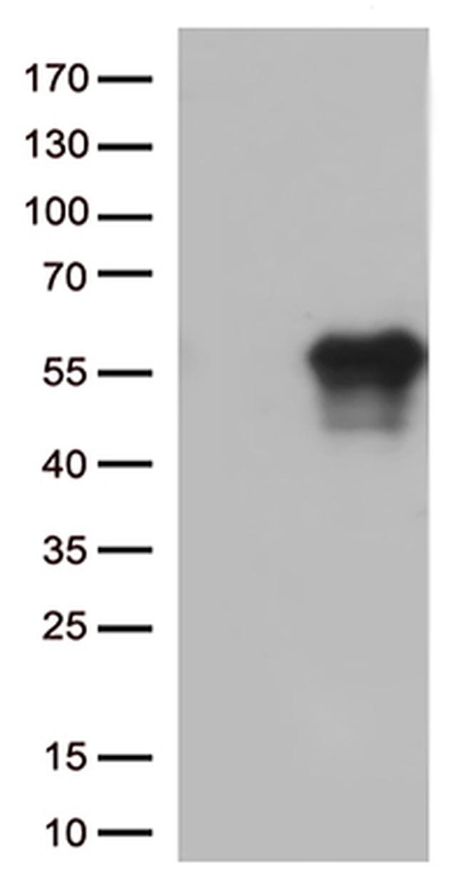 HAVCR2 Antibody in Western Blot (WB)