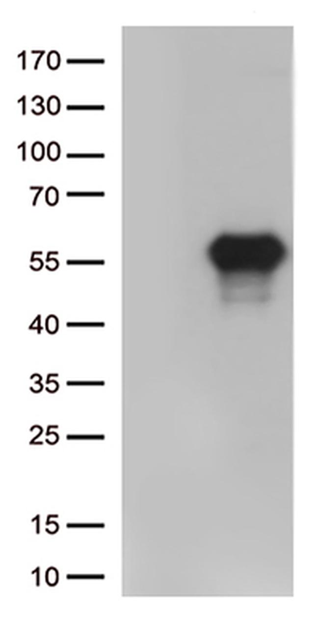 HAVCR2 Antibody in Western Blot (WB)