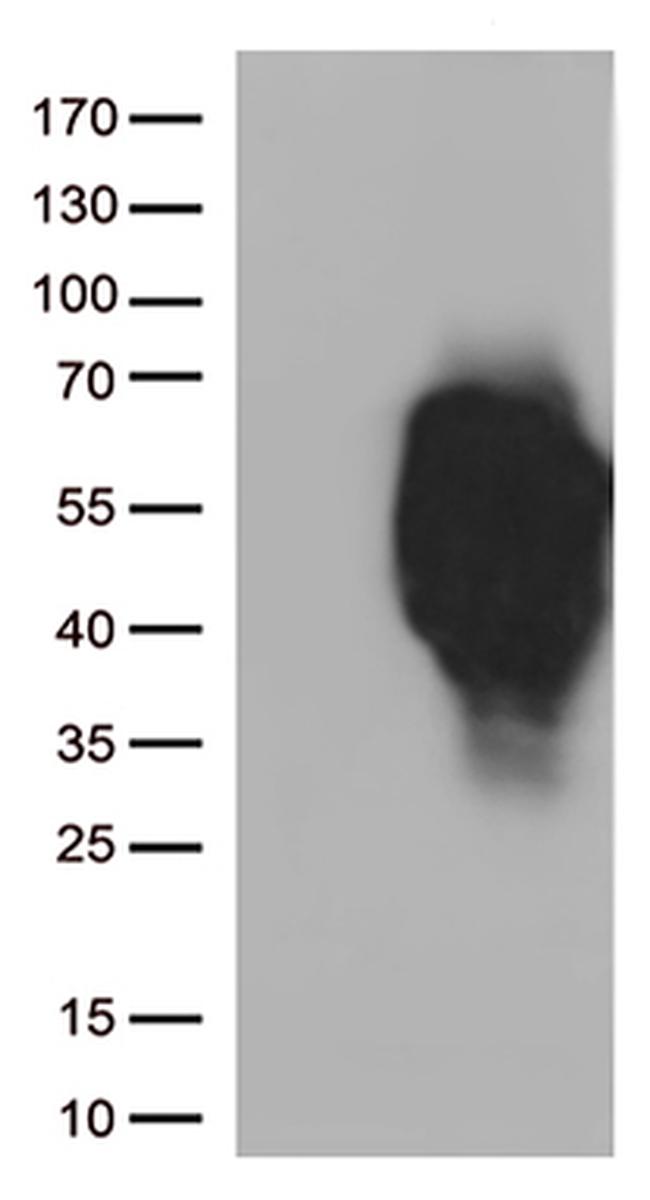 HAVCR2 Antibody in Western Blot (WB)