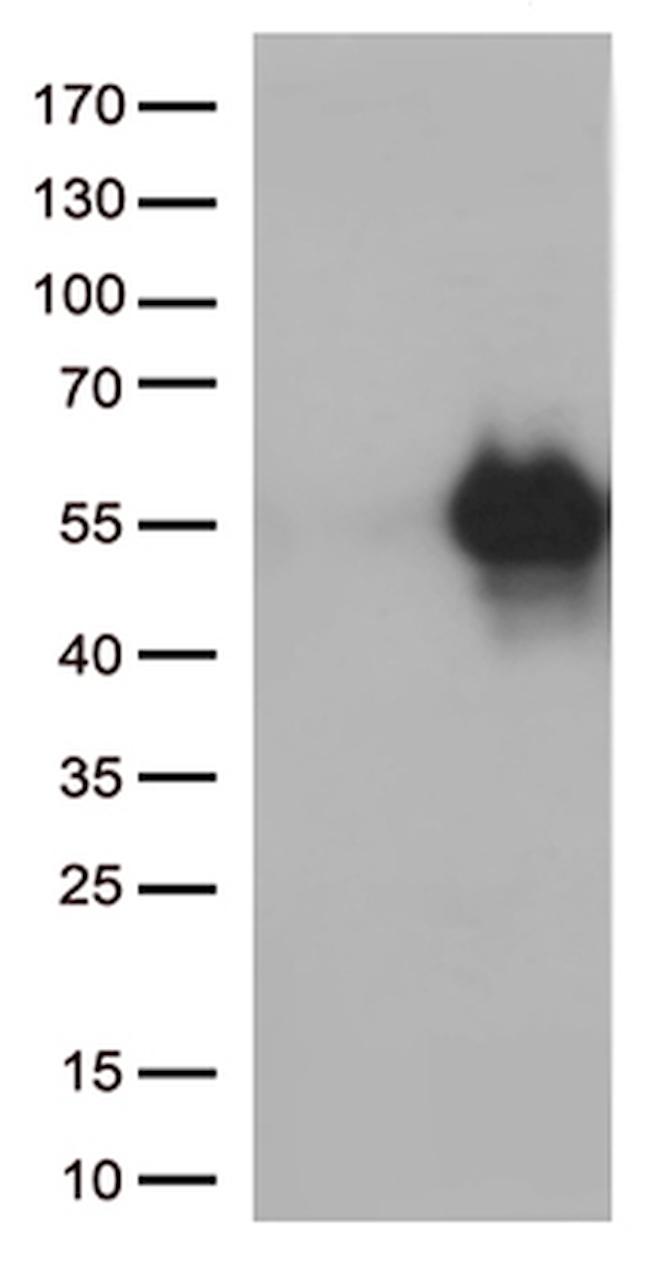 HAVCR2 Antibody in Western Blot (WB)