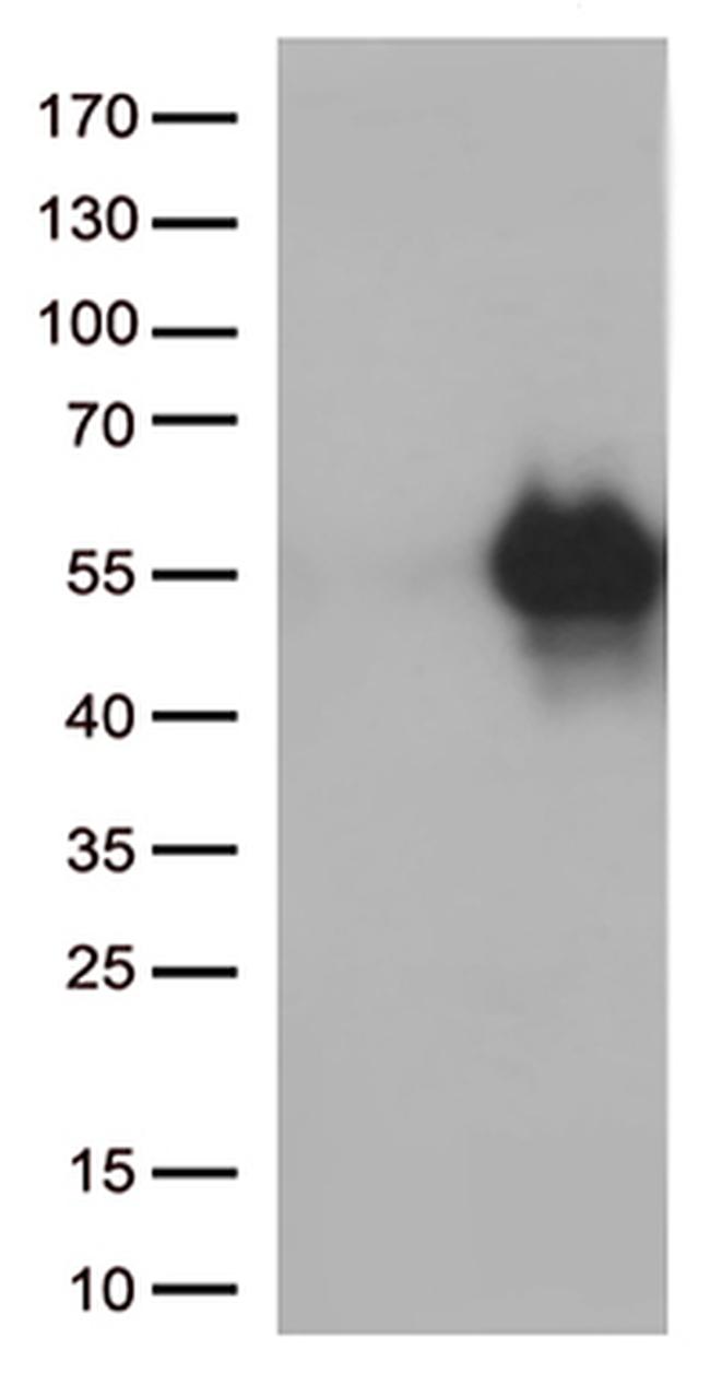 HAVCR2 Antibody in Western Blot (WB)