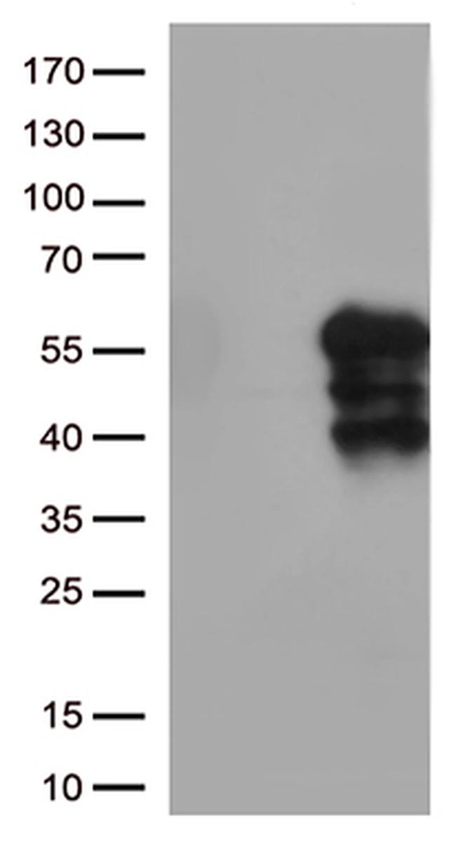 HAVCR2 Antibody in Western Blot (WB)