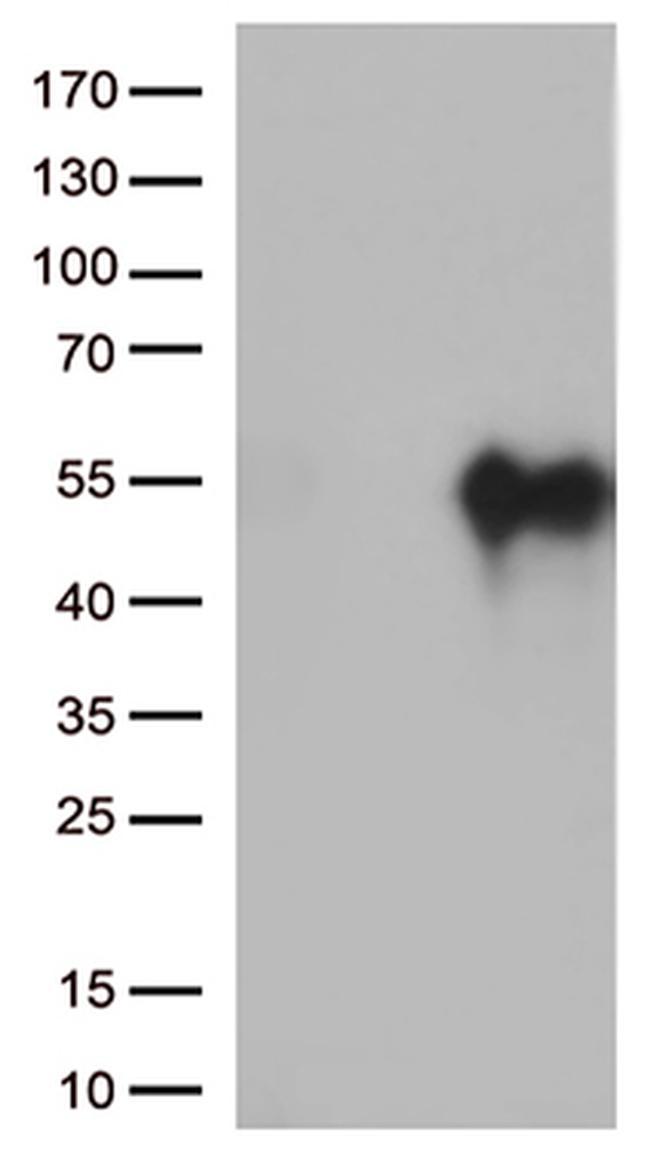 HAVCR2 Antibody in Western Blot (WB)