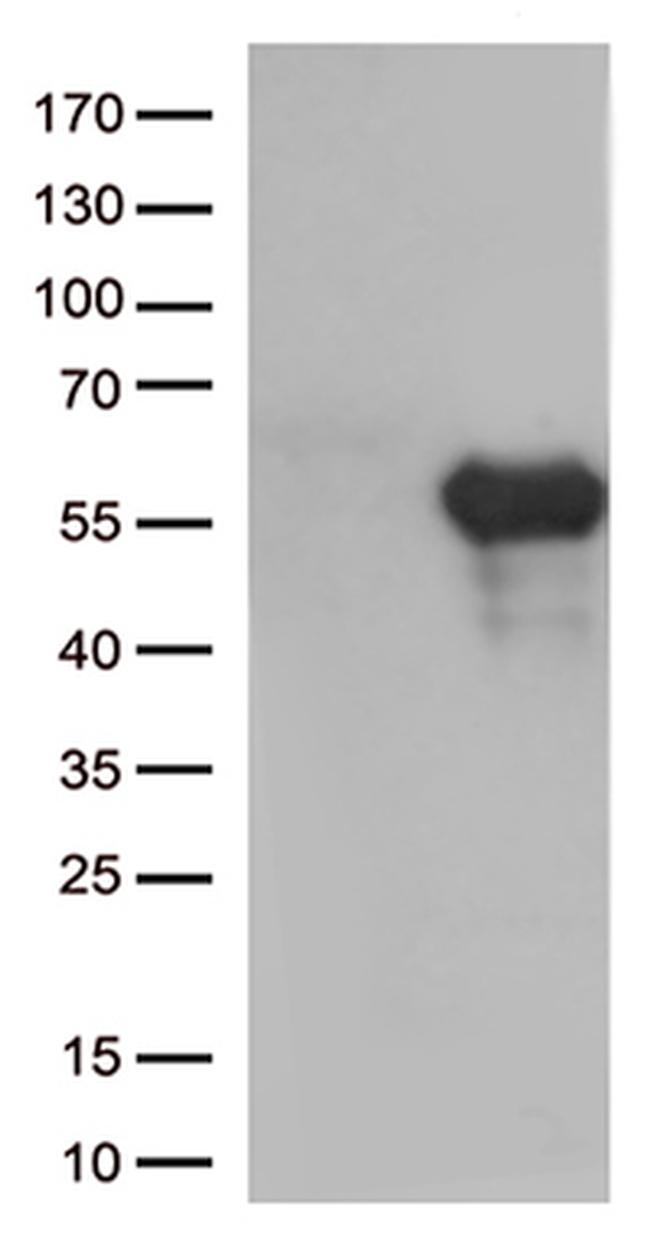HAVCR2 Antibody in Western Blot (WB)