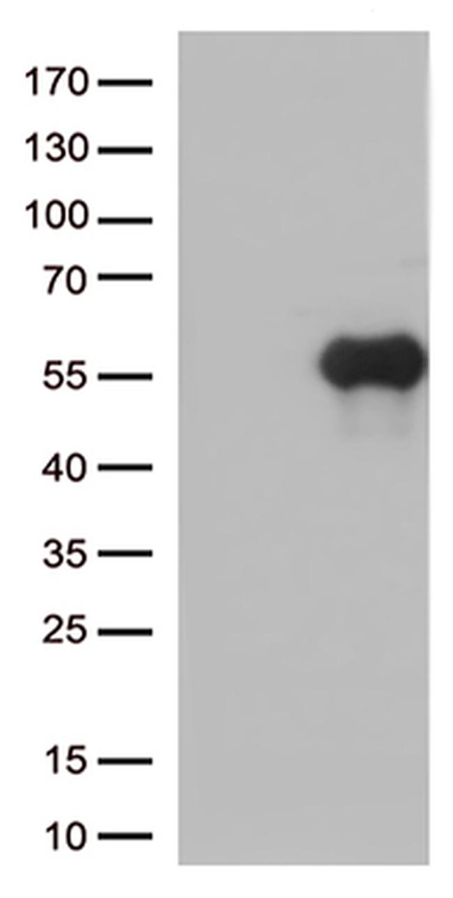 HAVCR2 Antibody in Western Blot (WB)