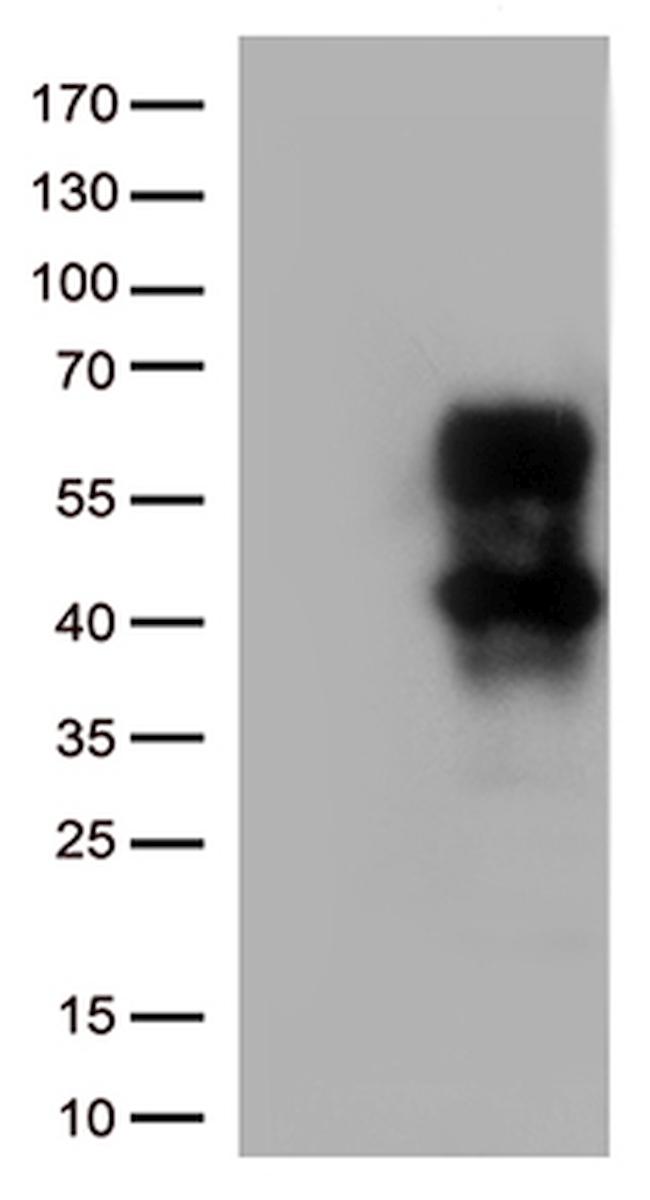 HAVCR2 Antibody in Western Blot (WB)