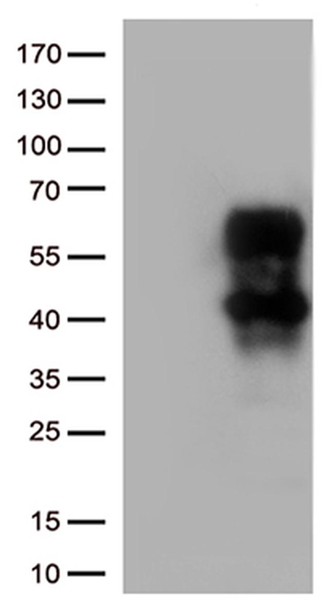 HAVCR2 Antibody in Western Blot (WB)
