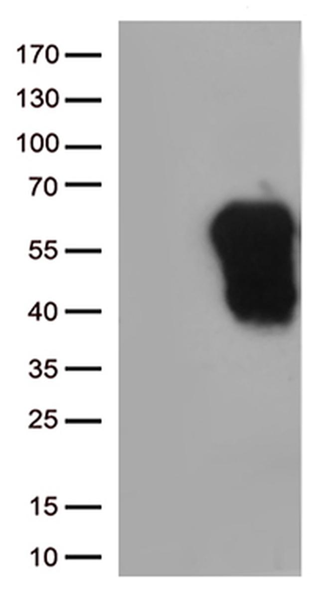 HAVCR2 Antibody in Western Blot (WB)